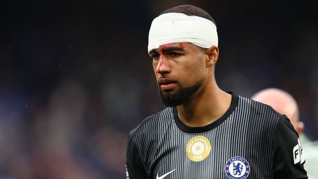 Chelsea Hope Three Injured Stars Return for FA Cup Final