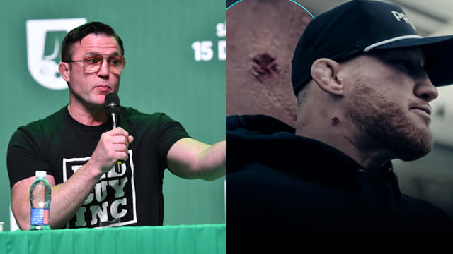 Chael Sonnen Says Justin Gaethje is Lying About "Ingrown Hair”