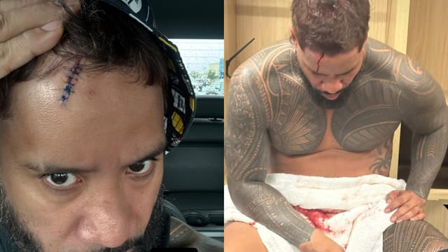 Jey Uso Shares Stitches Photo on Instagram After Wrestlepalooza Injury