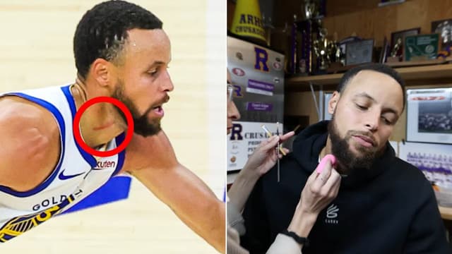 Stephen Curry Jokes About Starting “Scars With Steph Story Time” When He’s Done Playing