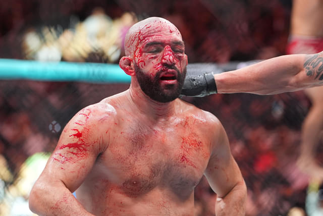 Jared Gordon Blasts Bettors After Fighting Post-Car Accident at Noche UFC