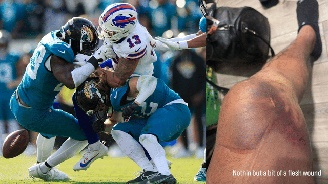 Gabe Davis Posts Graphic Knee Photo After Torn ACL vs Jaguars