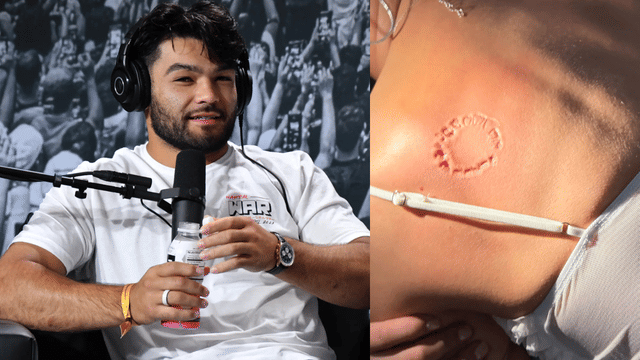 New Photo Reveals Alleged Bite Injury in Puka Nacua Lawsuit