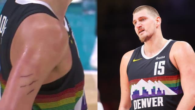 "Get Out The Coconut Oil": Eric Collins Baffled By Nikola Jokic's Deep Scars