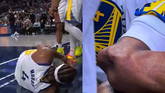 Moses Moody Suffers Gruesome Knee Injury Vs Mavs